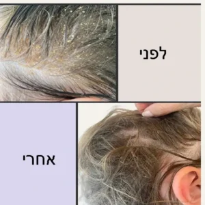 שמפו נגד קשקשים ללא מלחים תמונה 3
