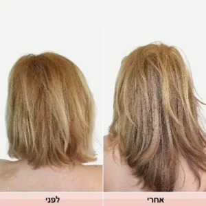 שמפו למניעת נשירת שיער - מעל 100 רכיבים ממקור טבעי תמונה 2