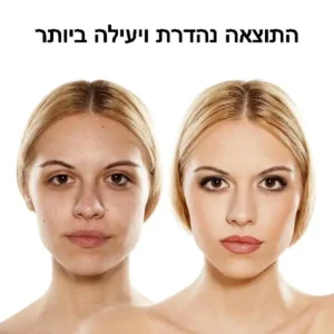 מסיכת פנים ביתית לד להפחתת קמטים ונגד הזדקנות תמונה 3