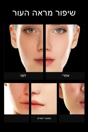 קרם פנים עם ניאצינמיד לטיפול בפיגמנטציה | לחות לעור מעורב וכיווץ נקבוביות תמונה 3