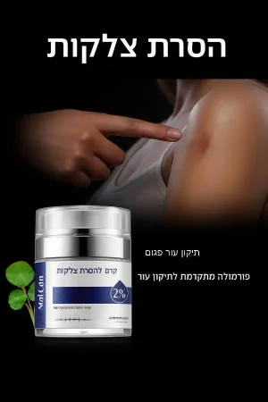 קרם לטיפול בצלקות וסימני מתיחה – משחה לשיקום העור (אקנה, ניתוחים וכוויות) תמונה 2